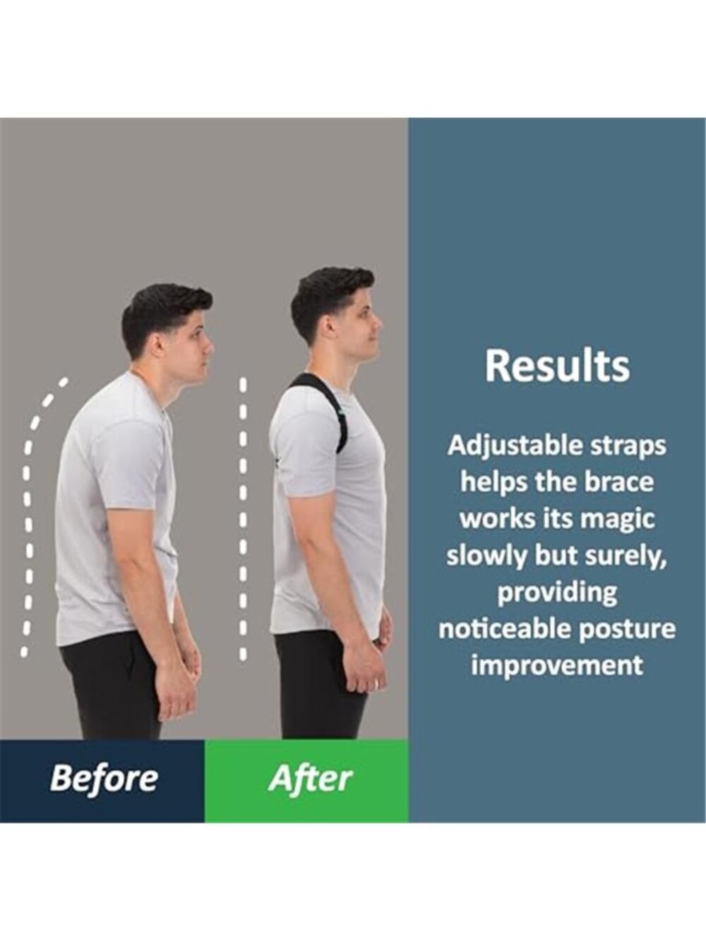 New ComfyBrace Posture Corrector-Back Brace for Men and Women- Fully Adjustable - Picture 2 of 6